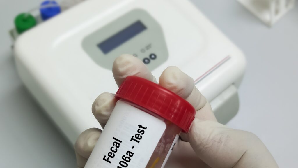 Doctor holding Fecal Egg Counting sample container